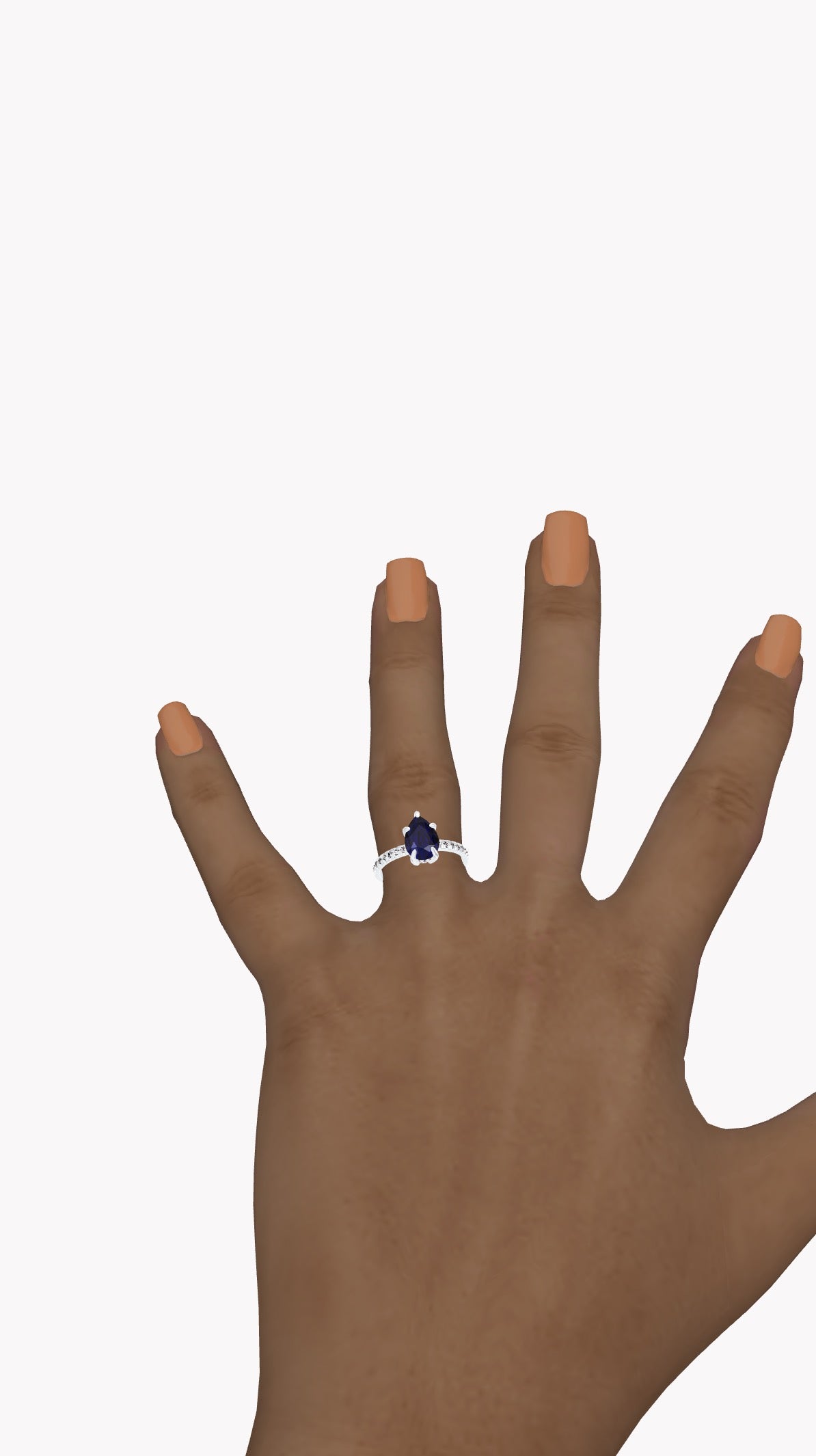 Ring 11401